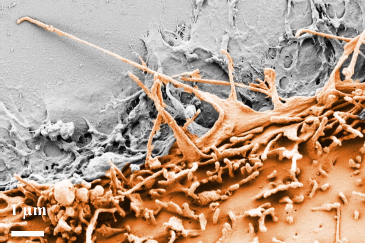 Scanning electron microscopy (SEM) image of human mammary epithelial MCF10A cells (orange) sensing a laser-ablated micro-defect on a collagen type I extracellular matrix surface through filopodial protrusions. Scale bar: 1µm. (Credit: Hannah Zmuda, Department of Biomedical Engineering, Washington University in St. Louis, with support from the Washington University Cellular Imaging Center (WUCCI)).